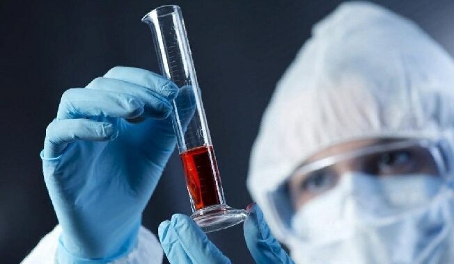 Ежедневно в Ивановской области делают 650 тестов на коронавирус