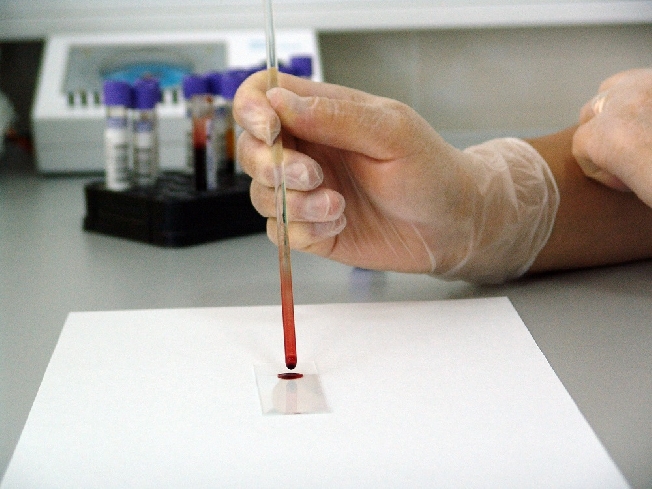 Среди доноров крови выявили семь ивановцев с ВИЧ