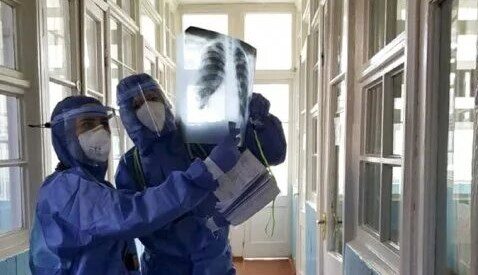 Число пневмоний стремительно увеличивается в Ивановкой области