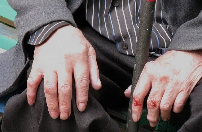 В Иванове пожилого мужчину жестоко избил уличный грабитель