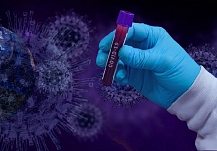 В Ивановской области выявили ещё 257 случаев заражения коронавирусной инфекцией