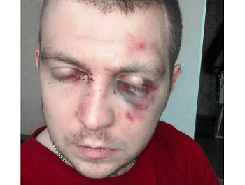 ����������-�������� ������� ������ � �������