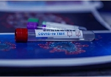 Ещё 120 жителей Ивановской области заболели коронавирусом