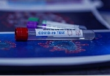 В Ивановской области выявили ещё 156 случаев заражения коронавирусом